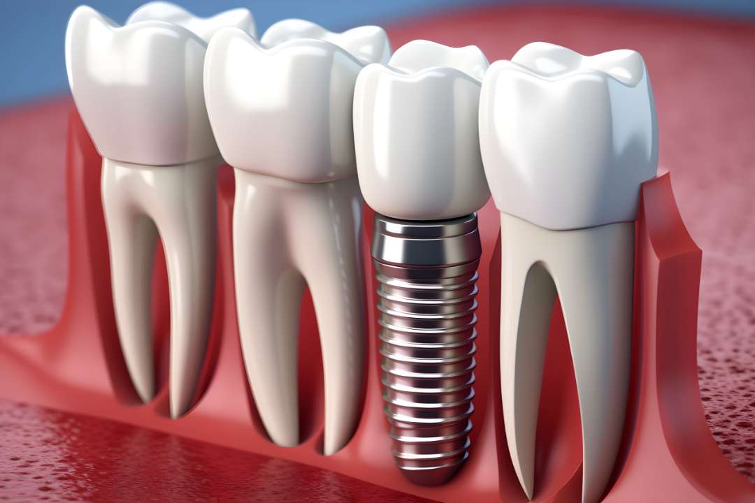 「歯周組織再生療法やインプラント治療など」先端的な治療にも対応